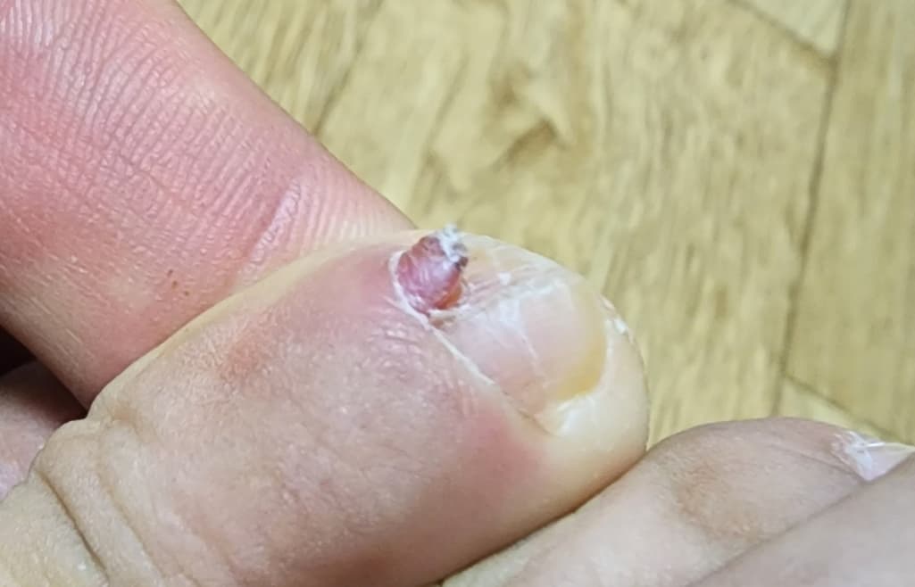 1번 째 사진