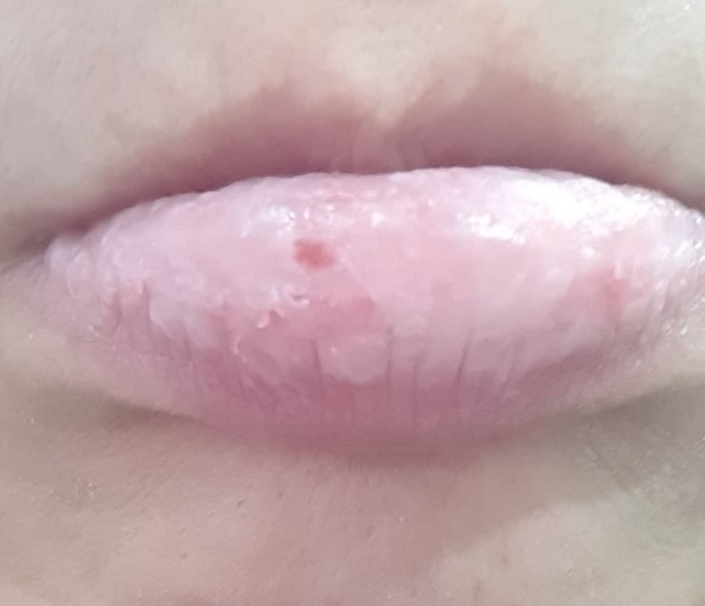 2번 째 사진