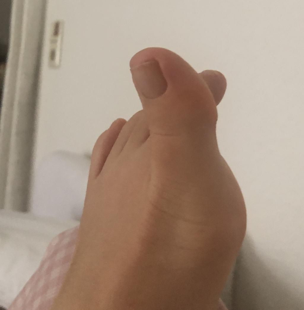 2번 째 사진