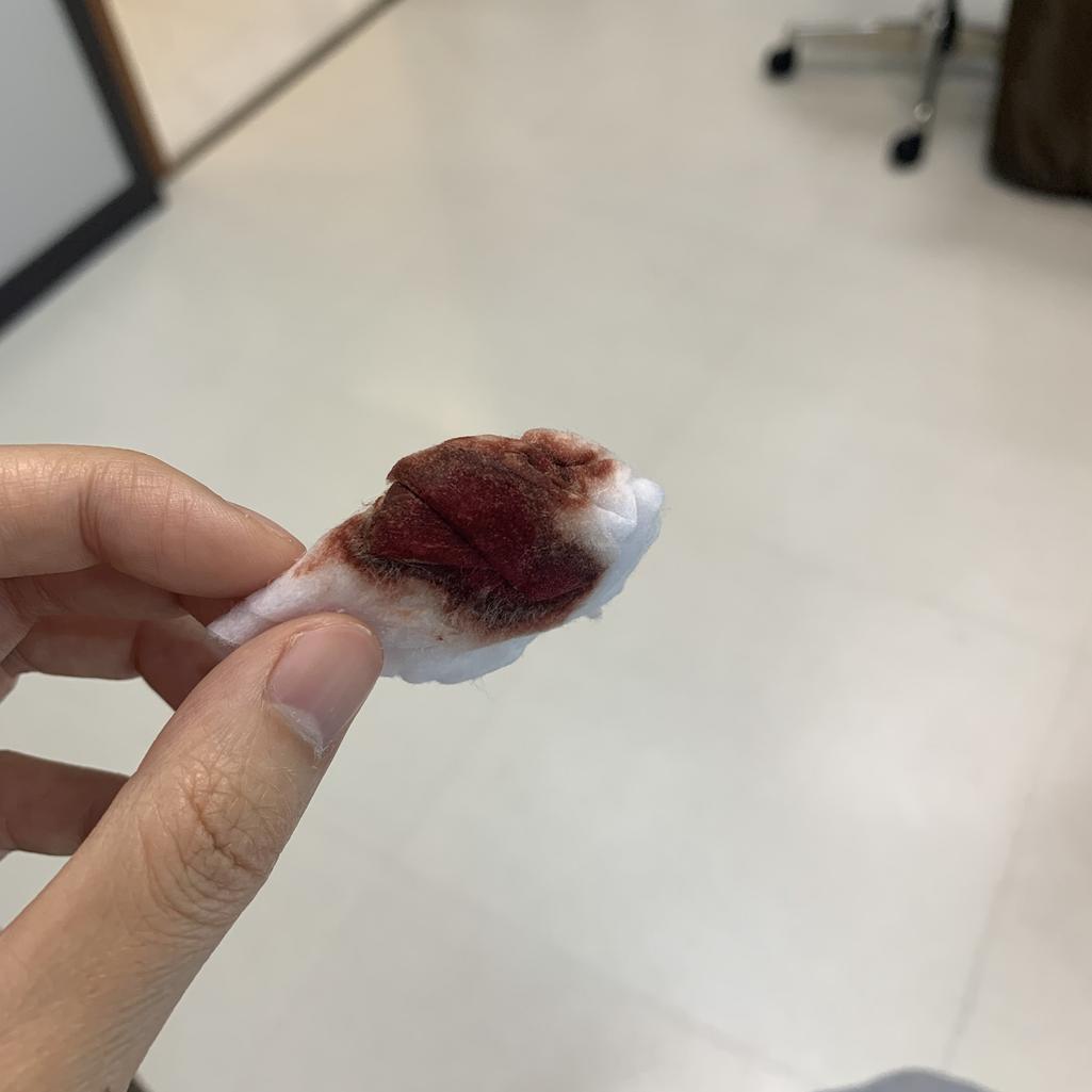 2번 째 사진