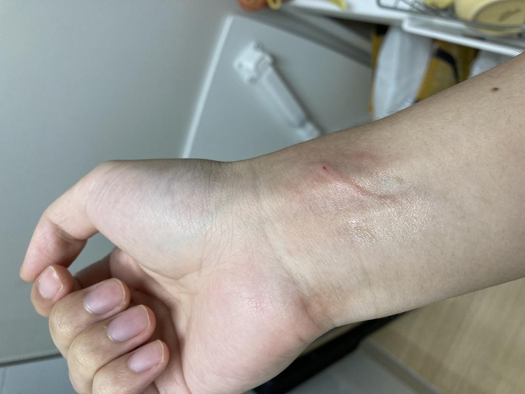 2번 째 사진