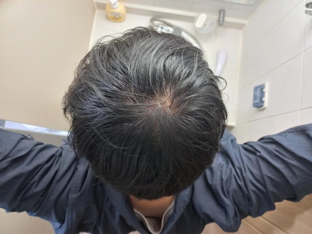 2번 째 사진