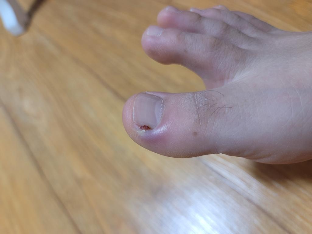 1번 째 사진