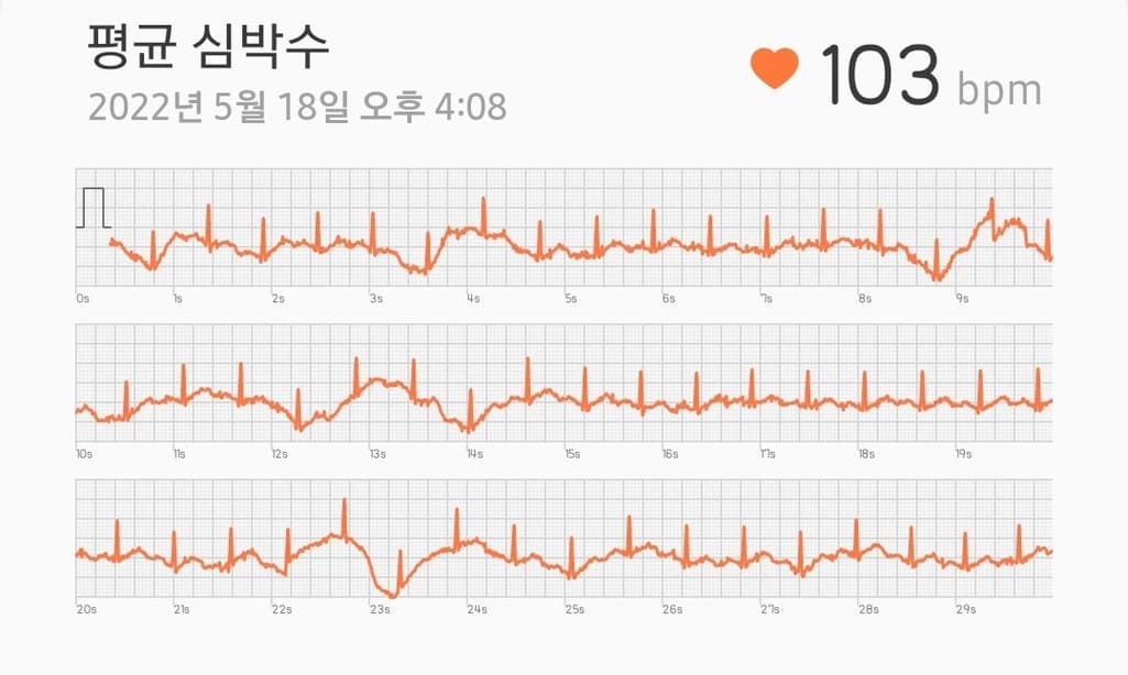 2번 째 사진