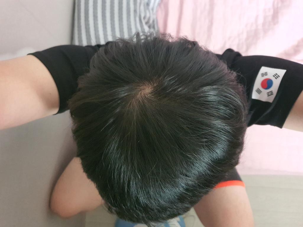 2번 째 사진