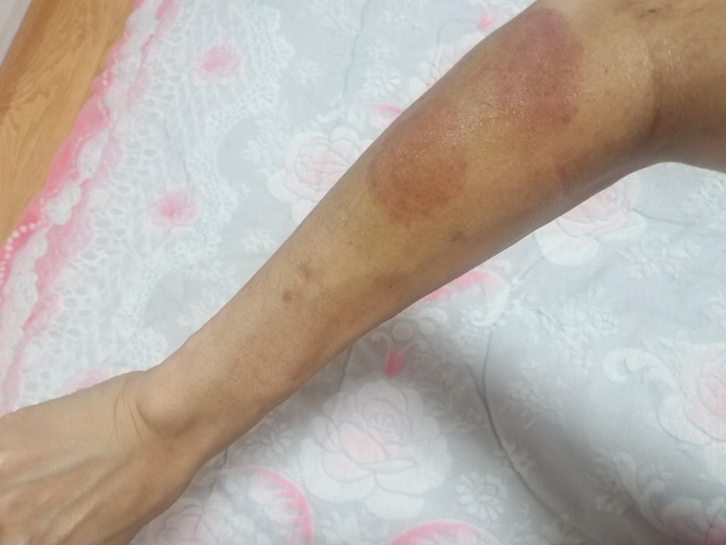2번 째 사진