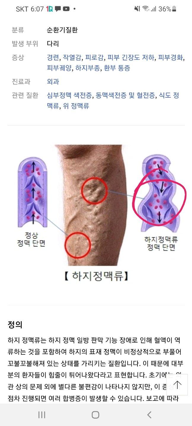 2번 째 사진