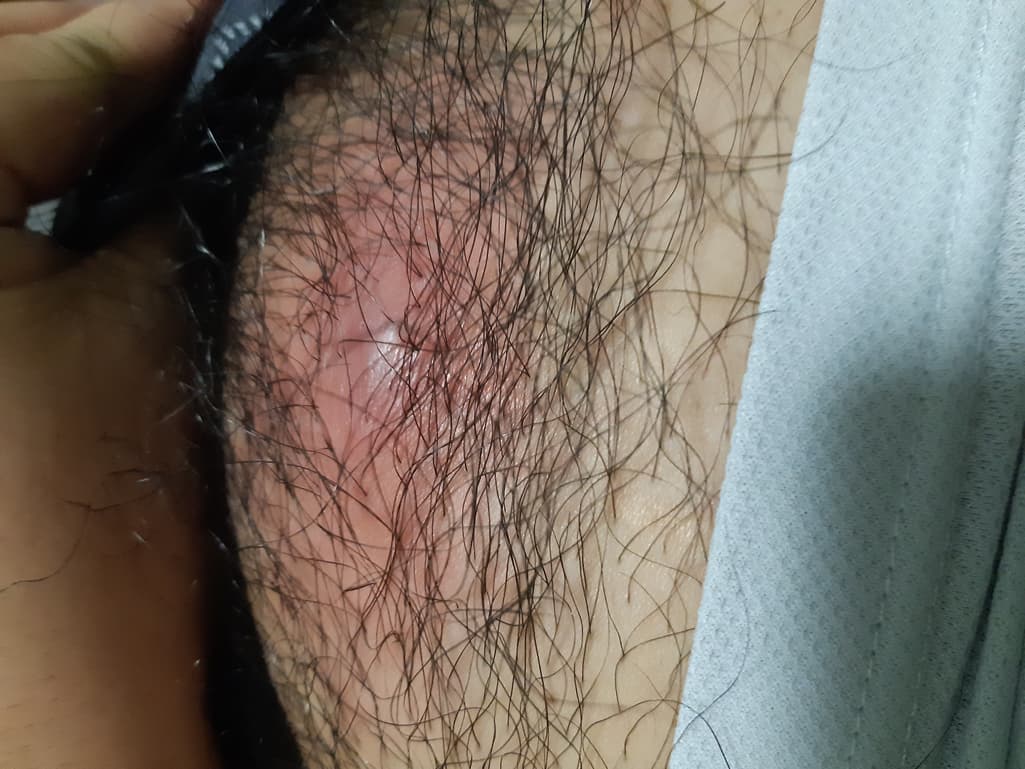 2번 째 사진