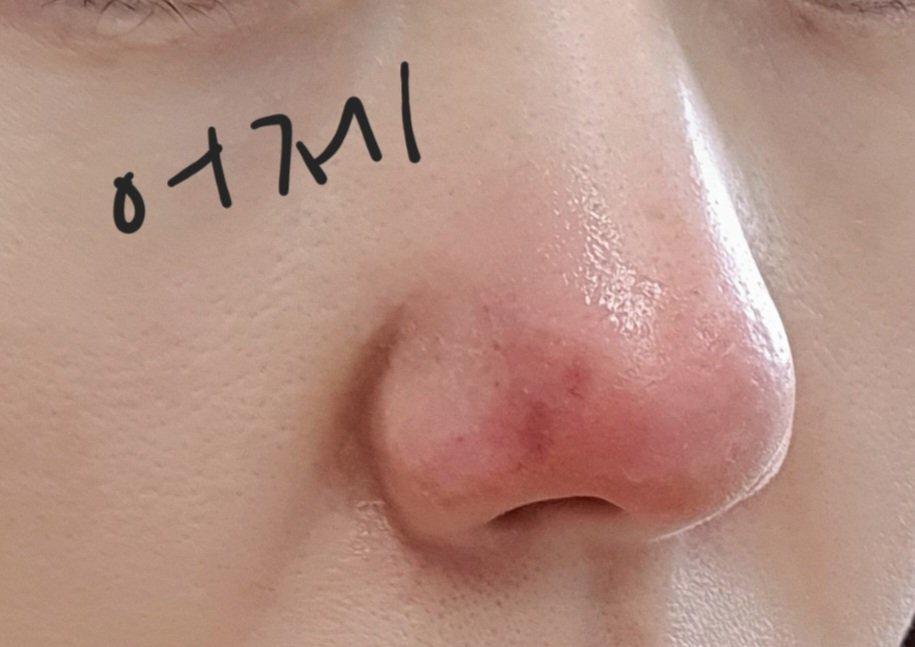 1번 째 사진