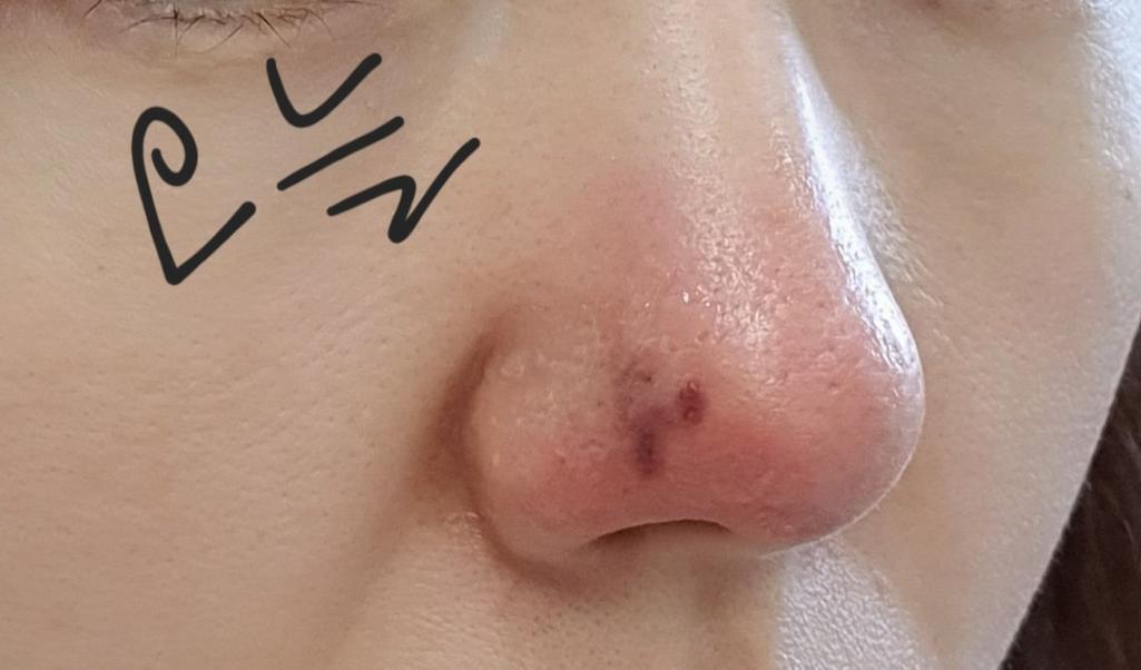 2번 째 사진
