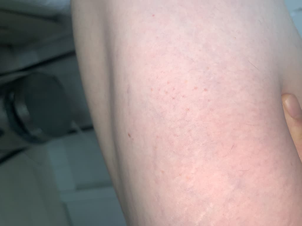 3번 째 사진