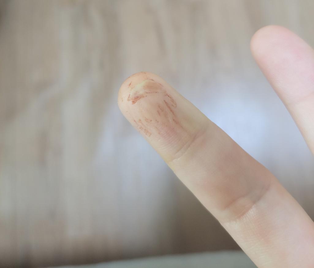 2번 째 사진