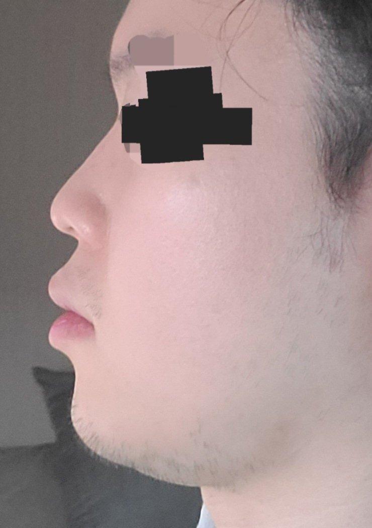 9번 째 사진