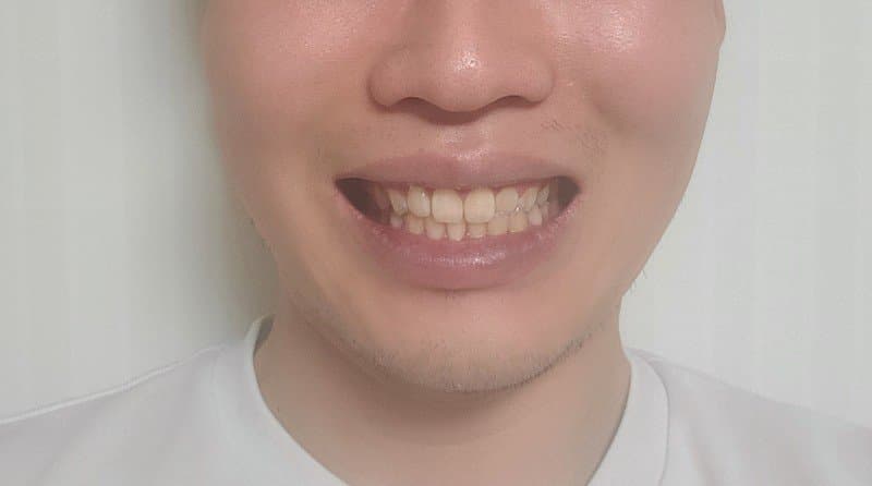 6번 째 사진