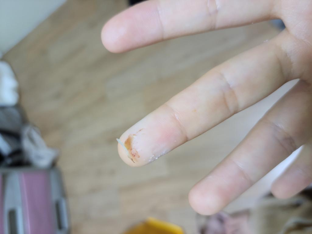 2번 째 사진
