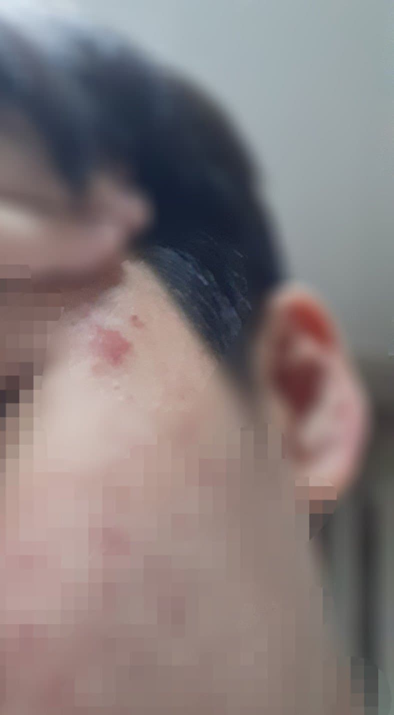 1번 째 사진
