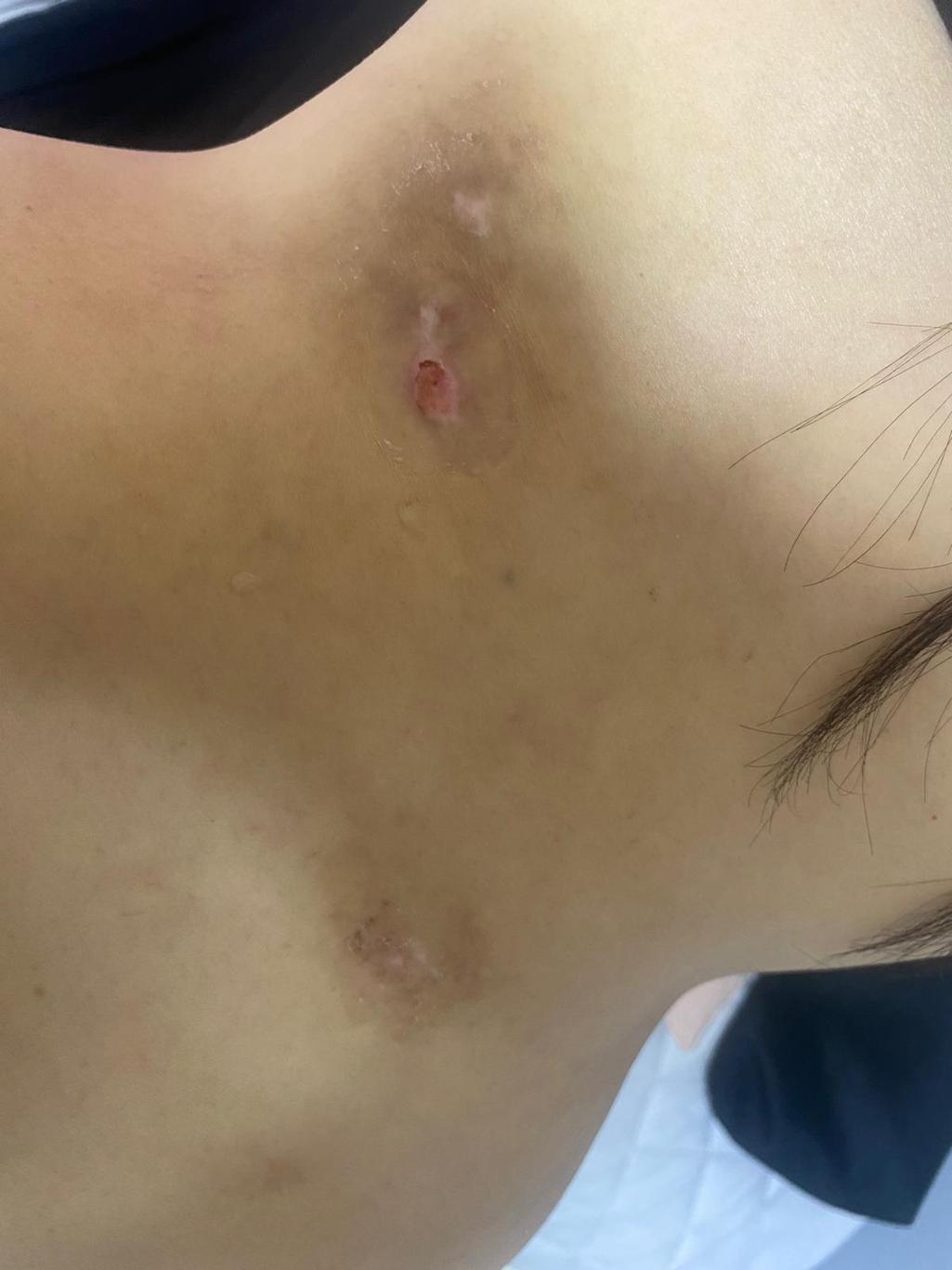 2번 째 사진
