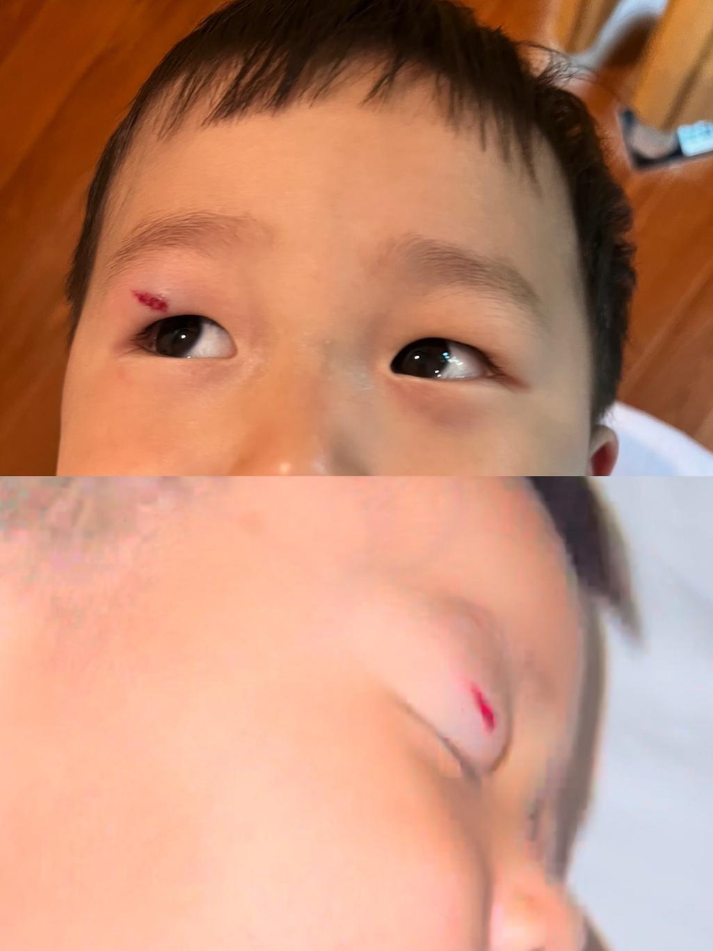 1번 째 사진