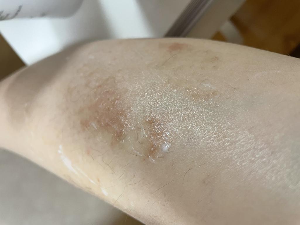 2번 째 사진