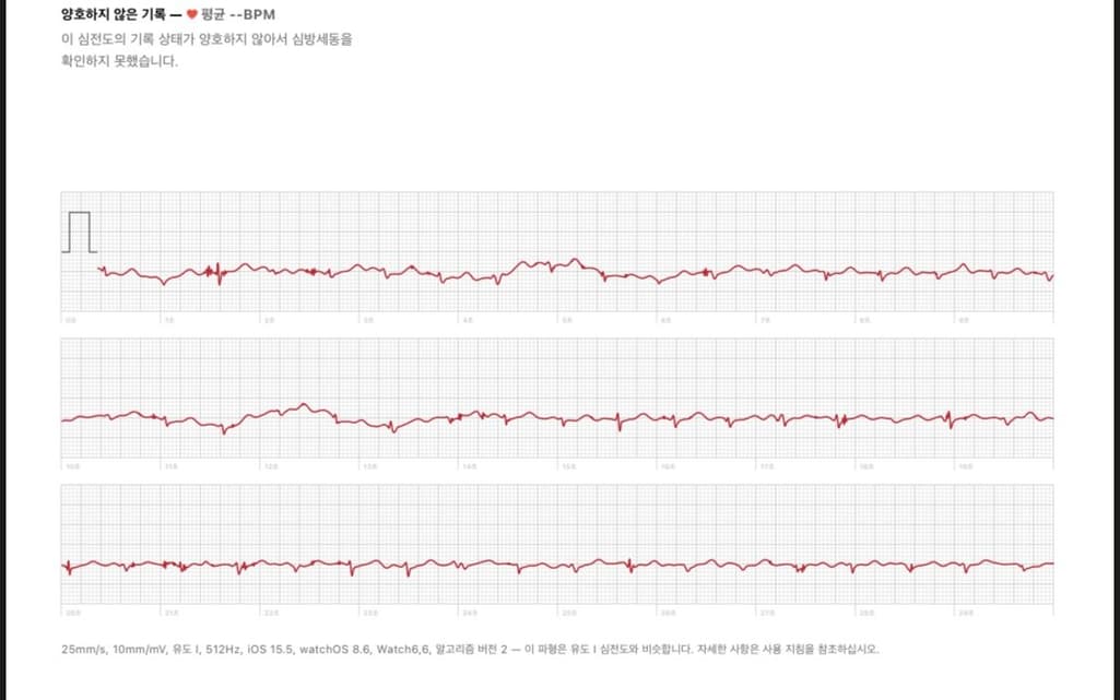 2번 째 사진