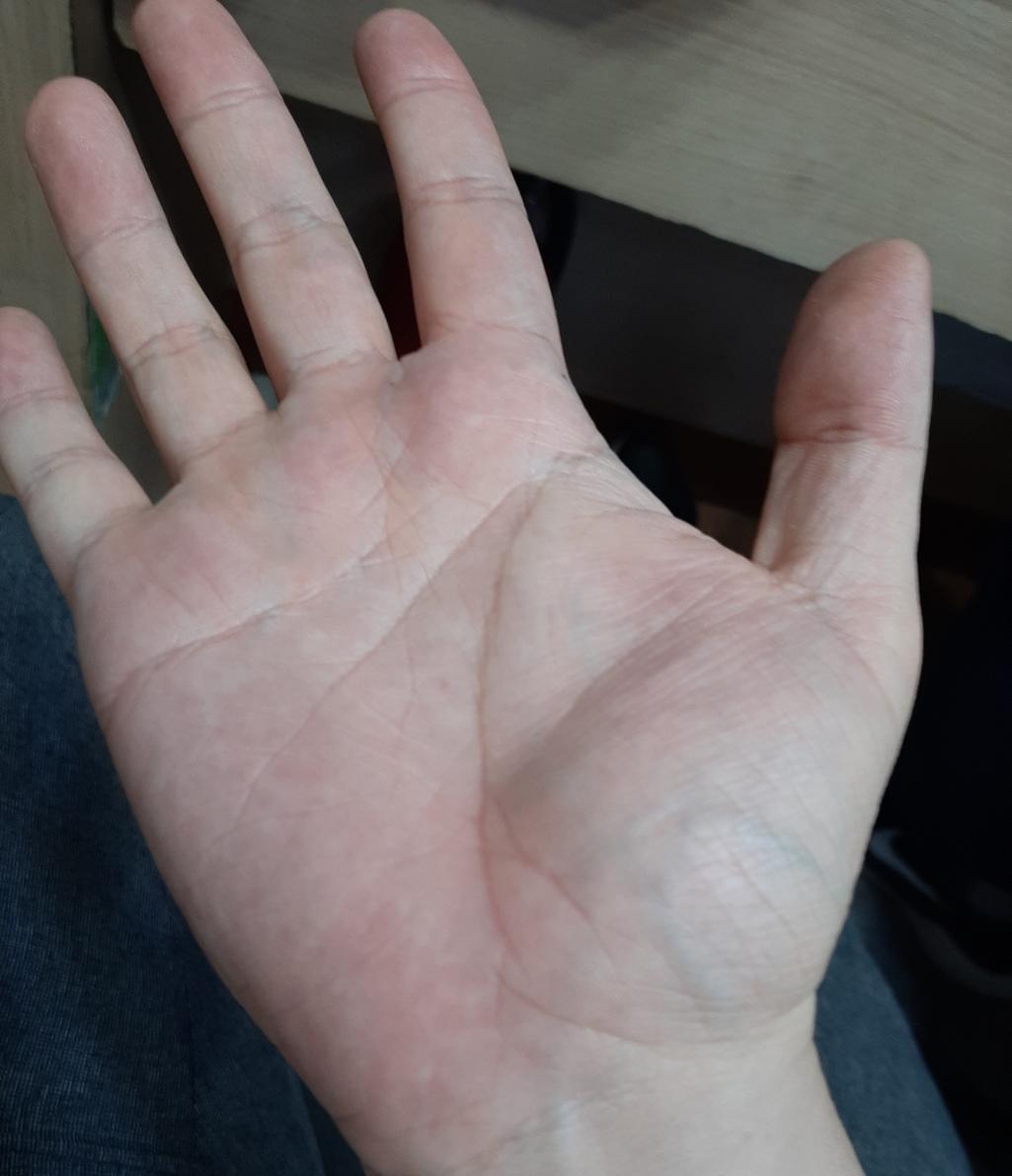 2번 째 사진