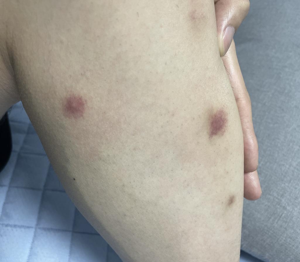 1번 째 사진