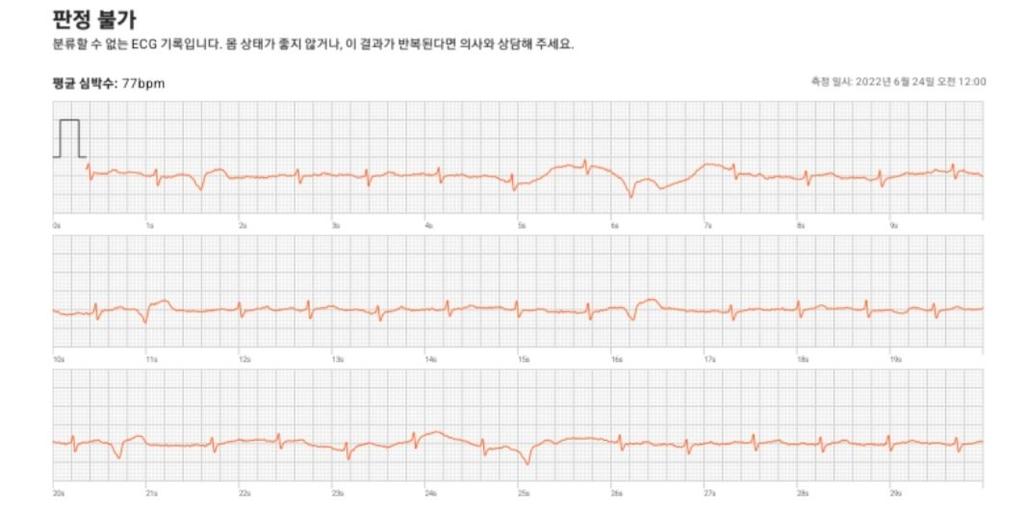 2번 째 사진