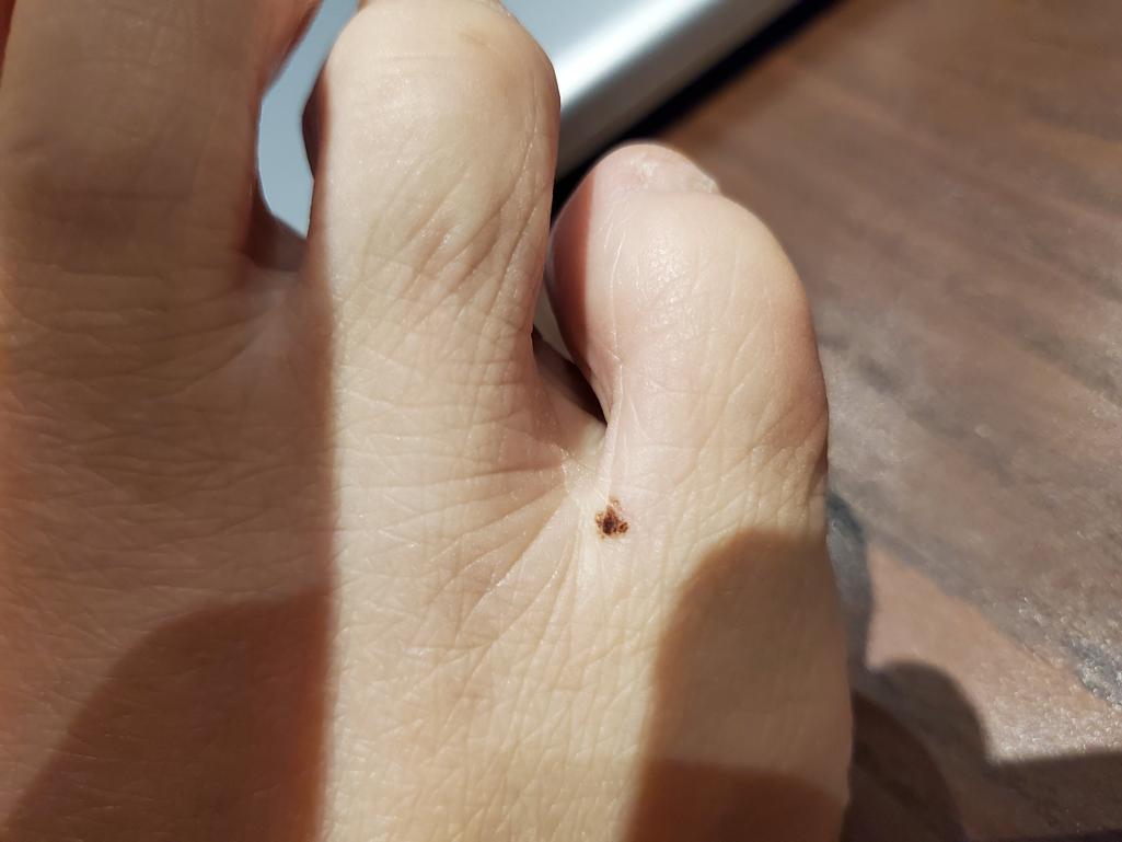 2번 째 사진