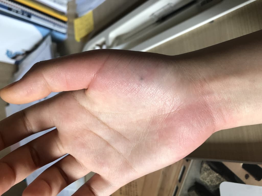 3번 째 사진