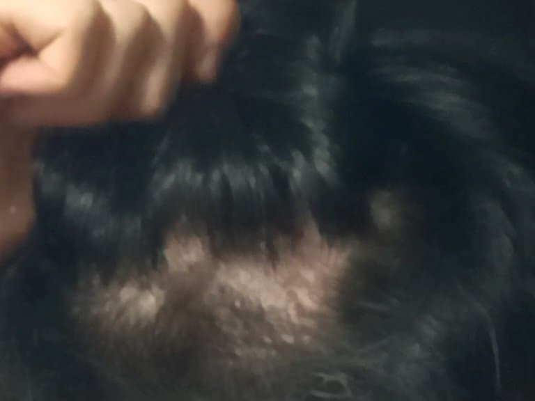 2번 째 사진