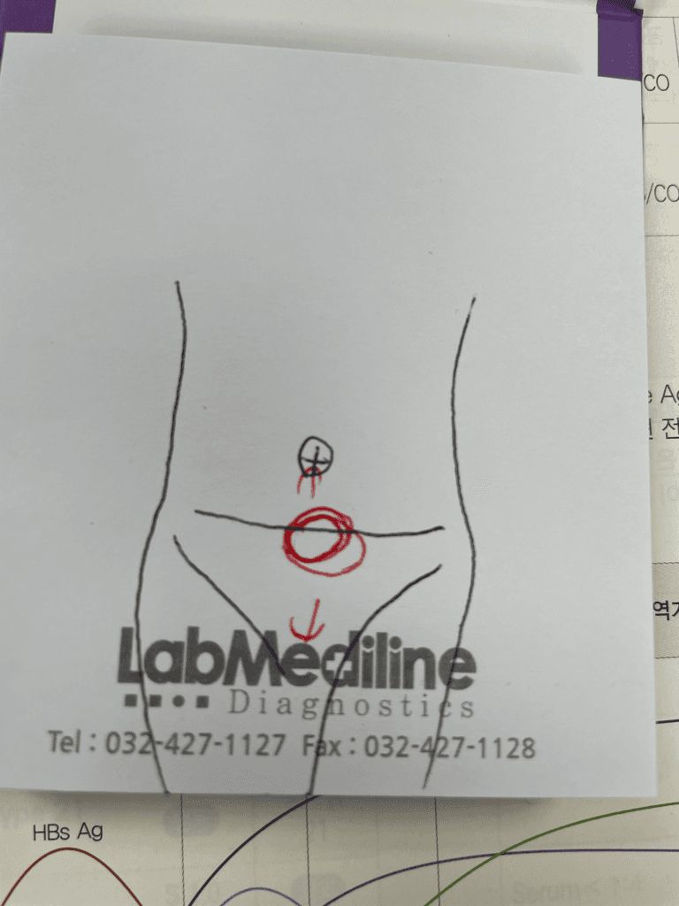 1번 째 사진