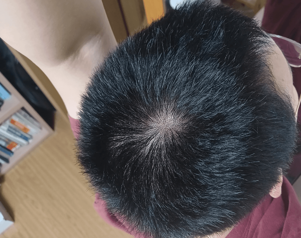 2번 째 사진