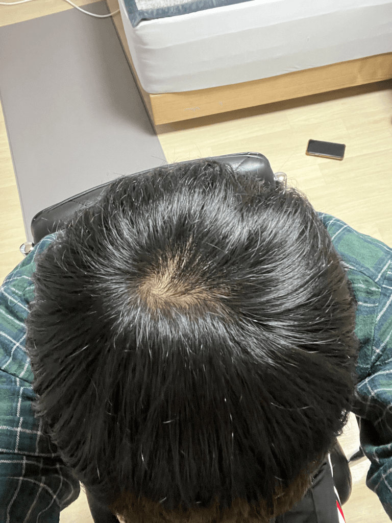 2번 째 사진