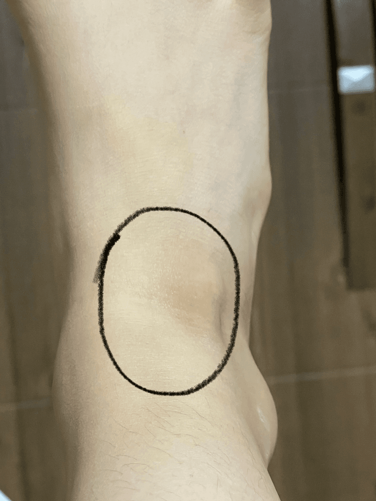 2번 째 사진