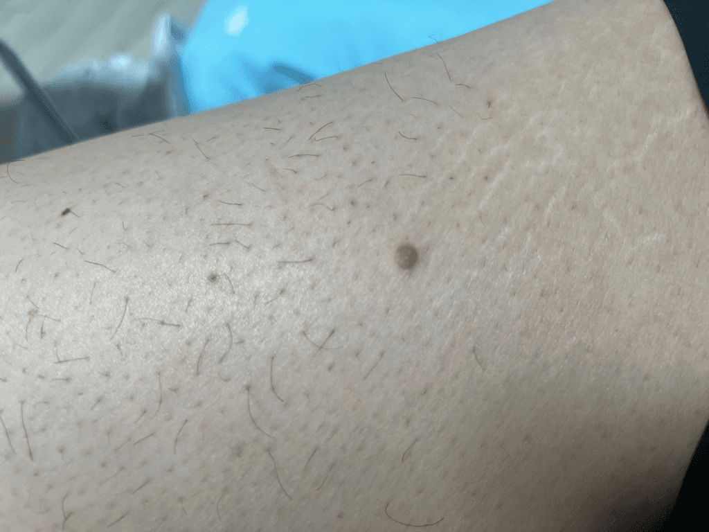 3번 째 사진