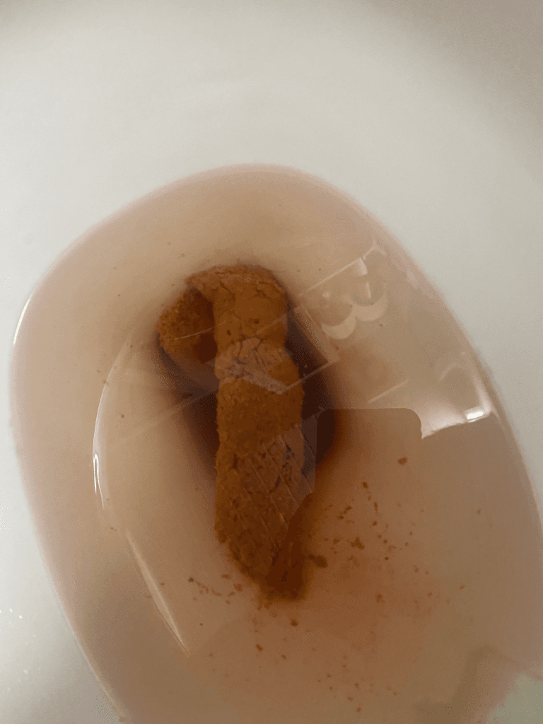 2번 째 사진