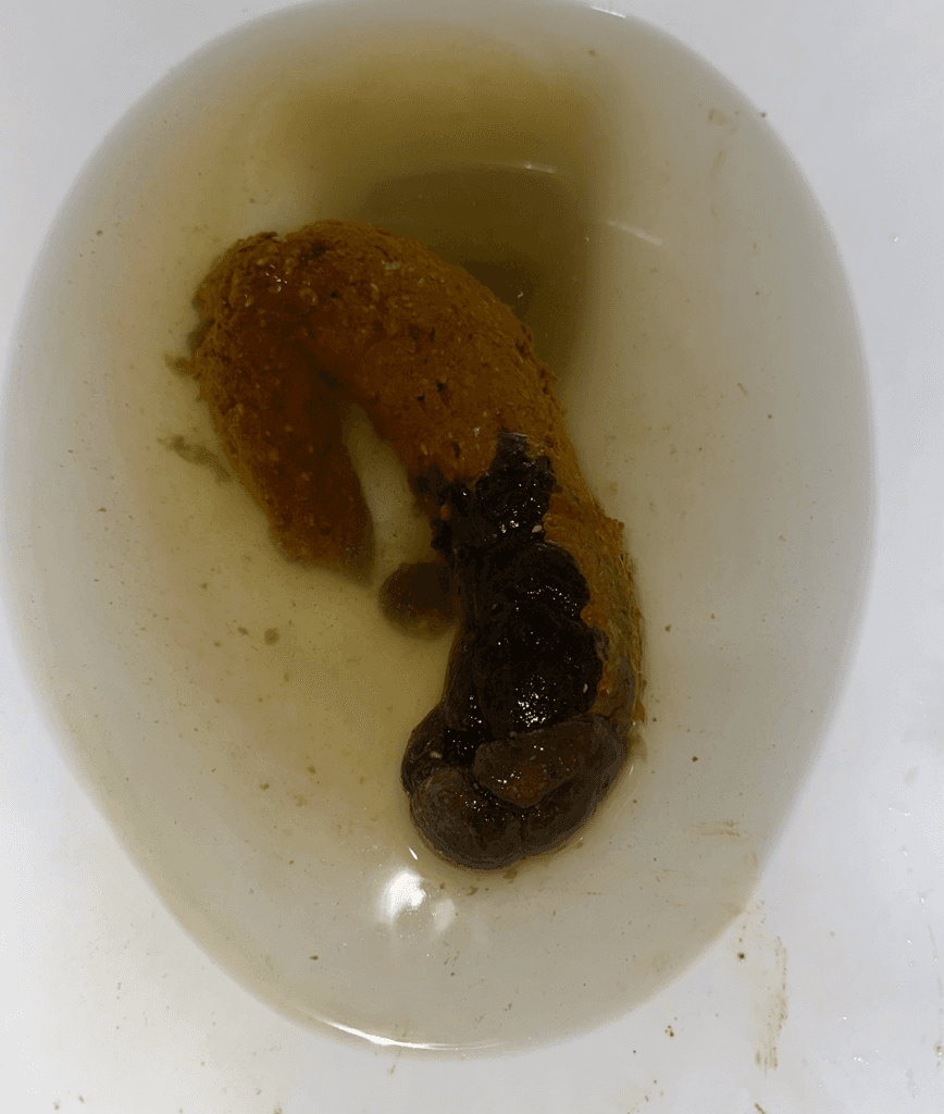 2번 째 사진