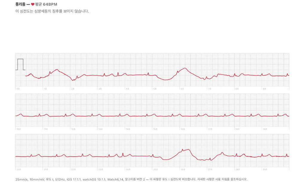 2번 째 사진