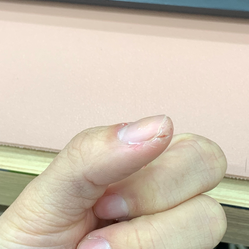 2번 째 사진