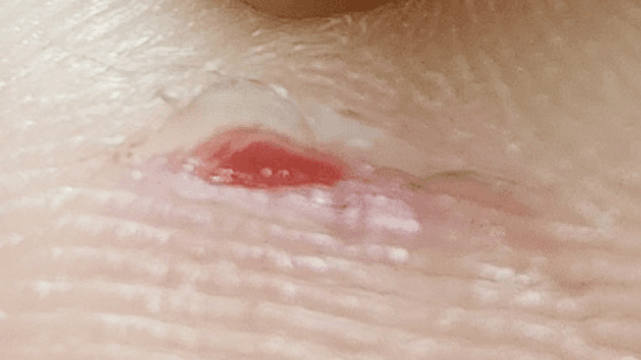 1번 째 사진