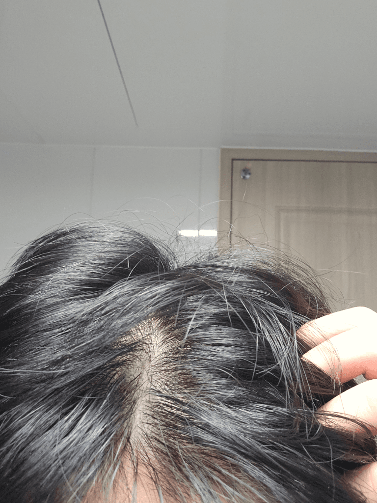 2번 째 사진