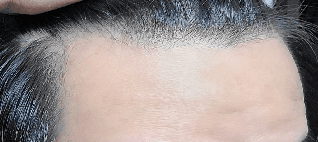 3번 째 사진