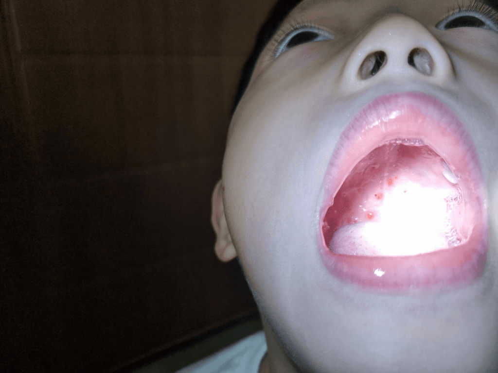 1번 째 사진