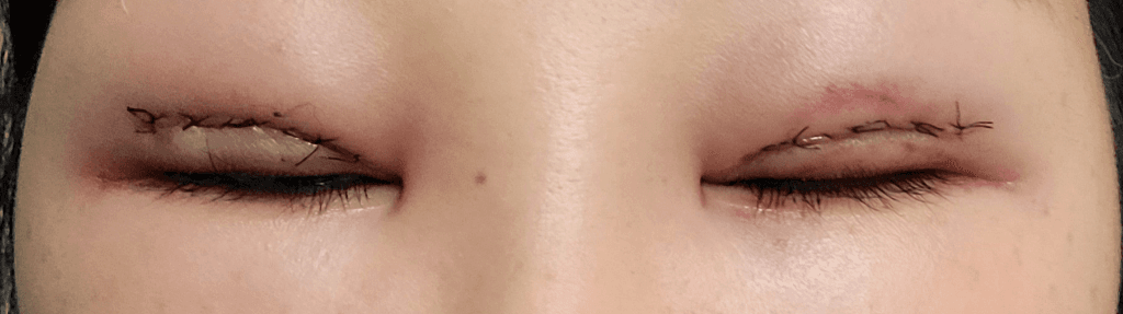 2번 째 사진