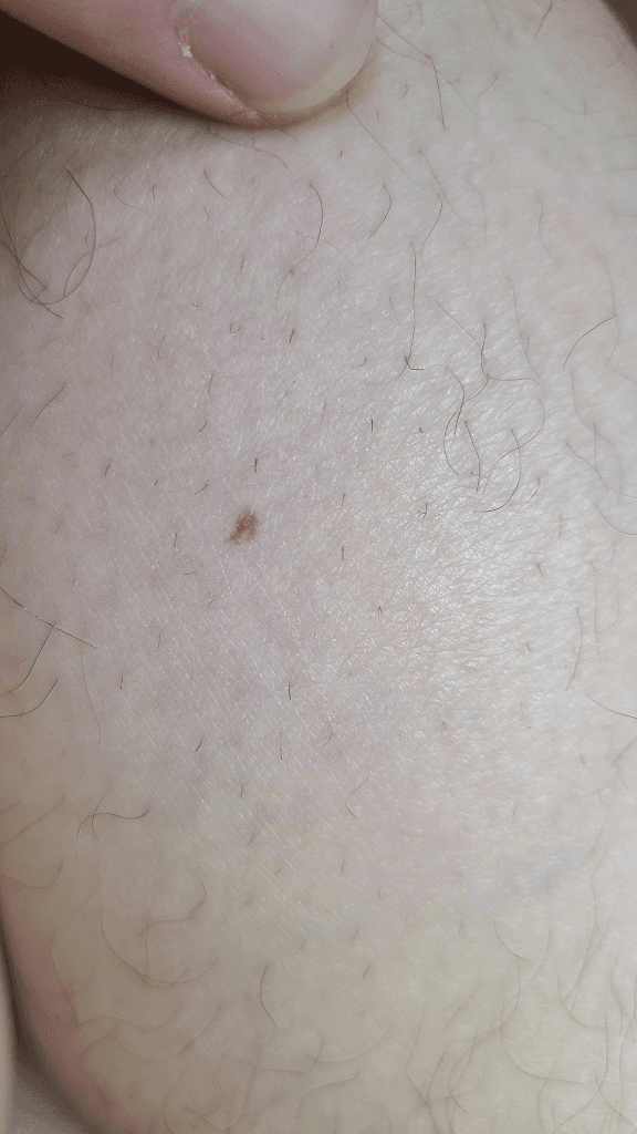 3번 째 사진