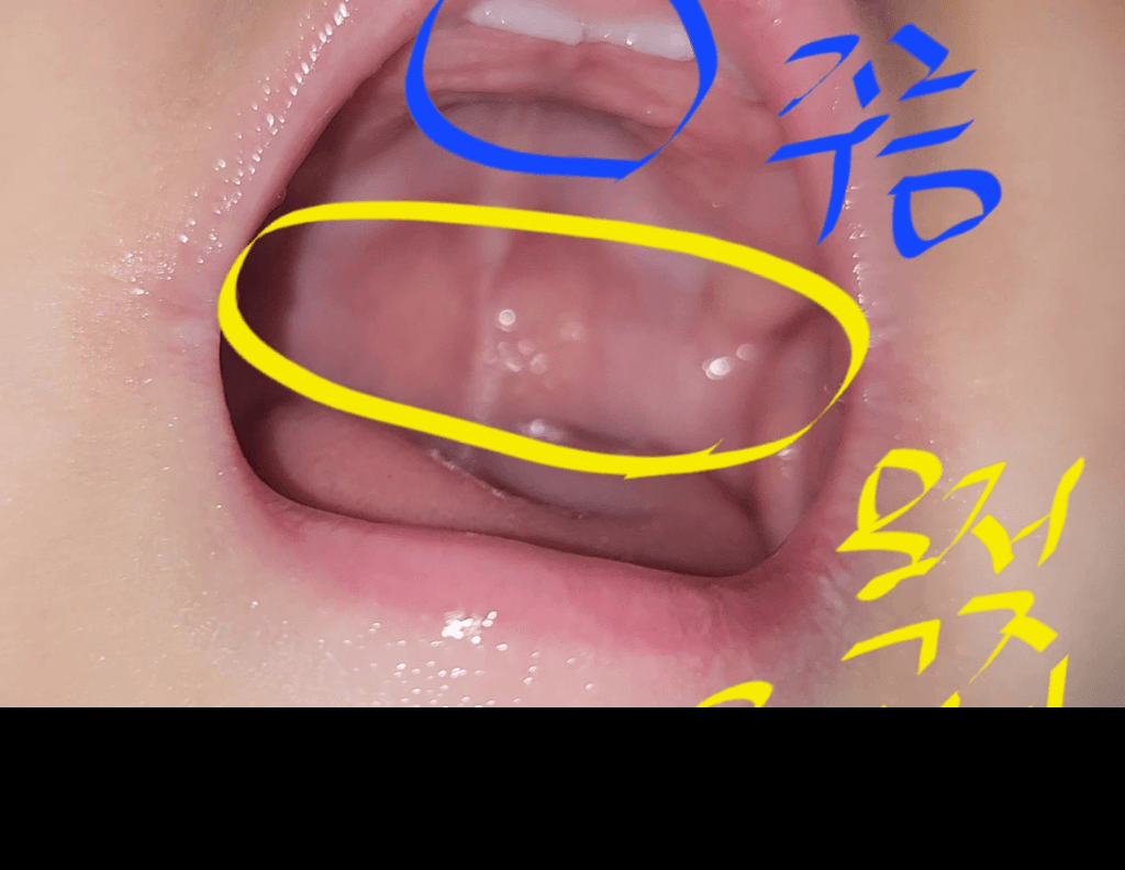 2번 째 사진