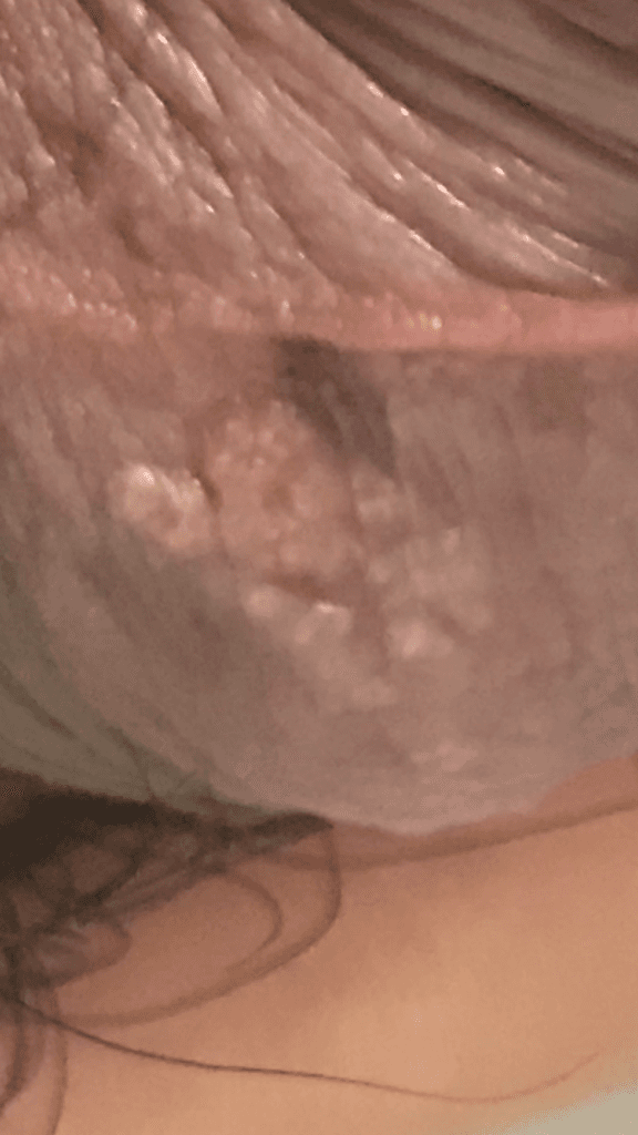 2번 째 사진