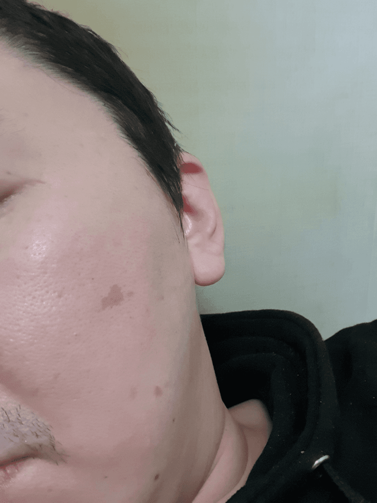 2번 째 사진