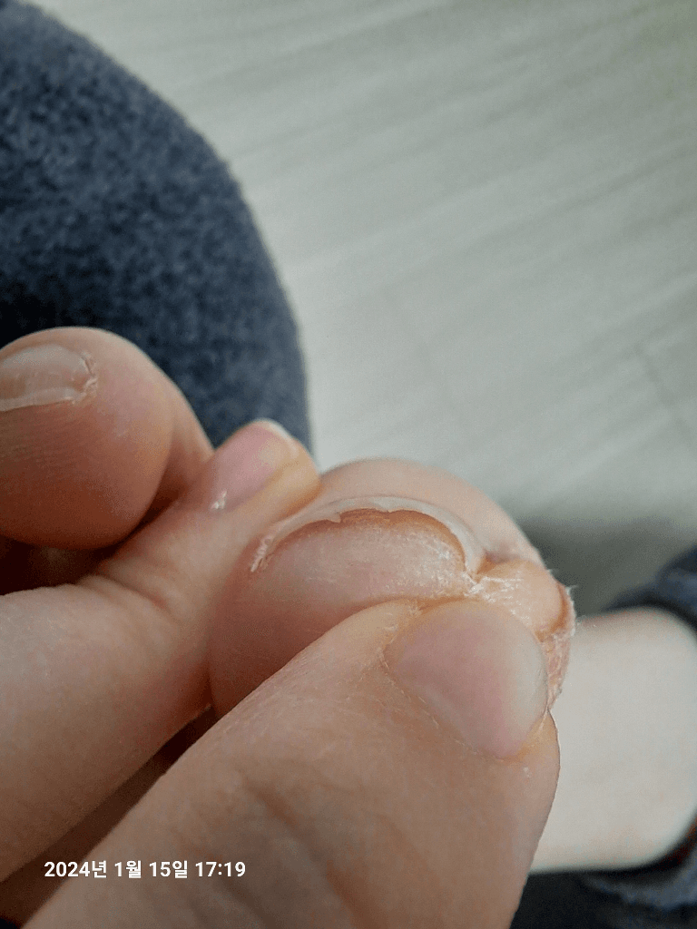 1번 째 사진