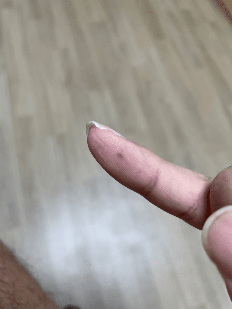 2번 째 사진